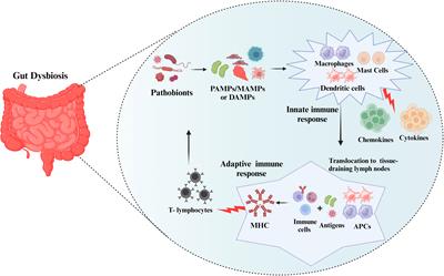 Protective effects of fecal microbiota transplantation against ischemic stroke and other neurological disorders: an update